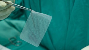 Waxahachie Defective Hernia Mesh Lawyer